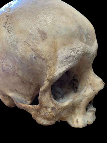 AN ANTIQUE MEDICAL OR TEACHING AID HUMAN SKULL