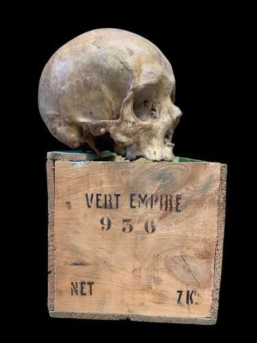 AN ANTIQUE MEDICAL OR TEACHING AID HUMAN SKULL
