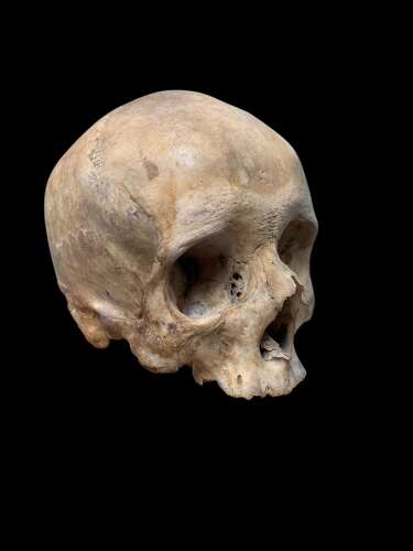 AN ANTIQUE MEDICAL OR TEACHING AID HUMAN SKULL