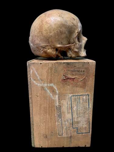 AN ANTIQUE MEDICAL OR TEACHING AID HUMAN SKULL