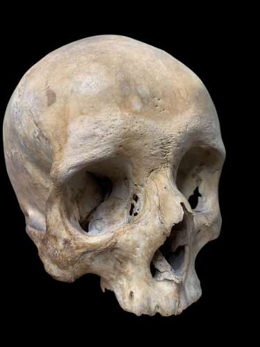 AN ANTIQUE MEDICAL OR TEACHING AID HUMAN SKULL