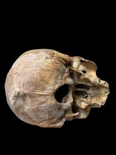 AN ANTIQUE MEDICAL OR TEACHING AID HUMAN SKULL