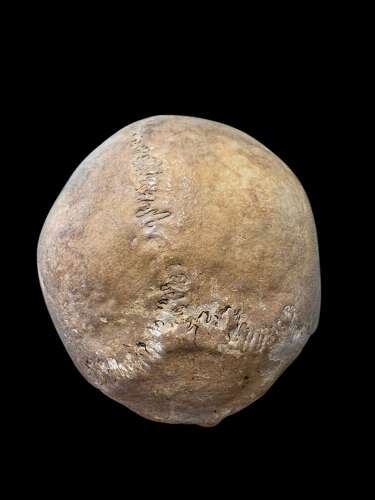 AN ANTIQUE MEDICAL OR TEACHING AID HUMAN SKULL